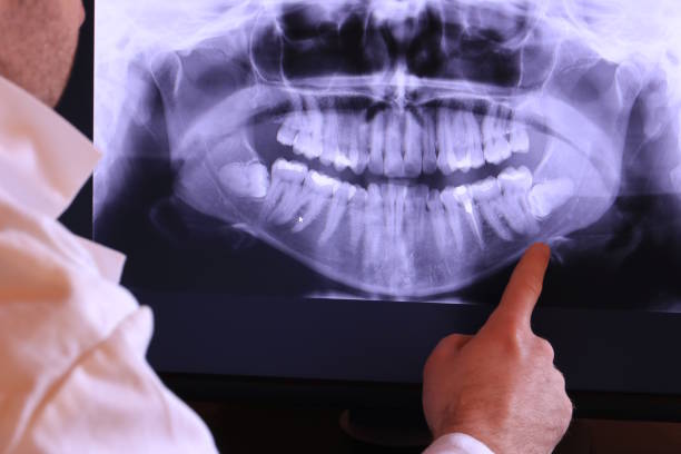 Best Emergency Tooth Extraction in Tiffin, IA